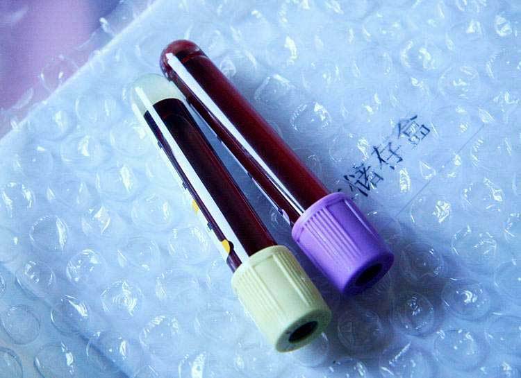 要在绿巨人APP色APP冷链物流行业发展需要哪些技术